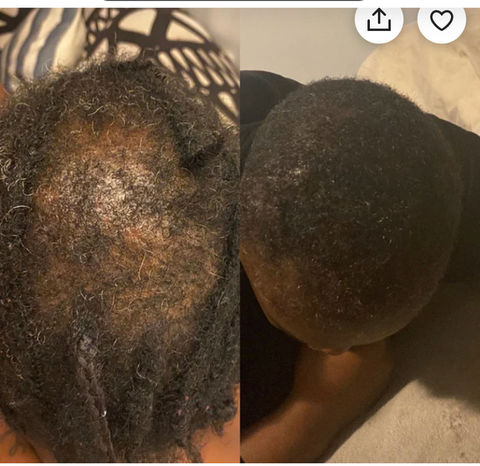 Anne & Suze Natural Hair Products Distributor in Miami Gardens, FL (4)