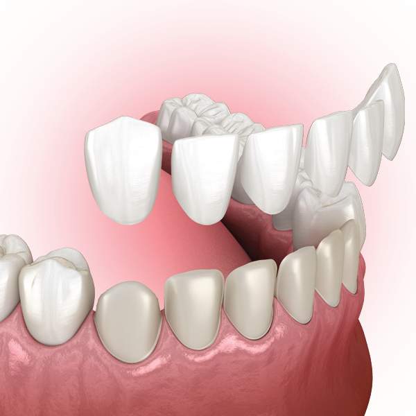 Colson Dental Group in Raleigh, NC