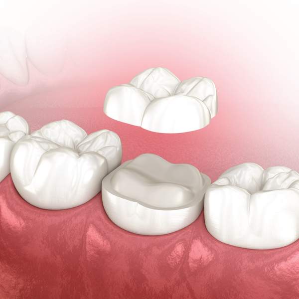 Colson Dental Group in Raleigh, NC (2)