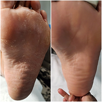 Heal by Sole Mobile Wellness Pedicures in Richmond, VA (4)
