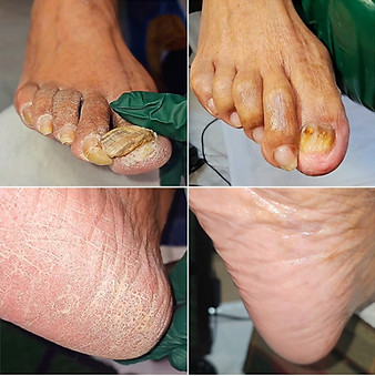 Heal by Sole Mobile Wellness Pedicures in Richmond, VA (5)