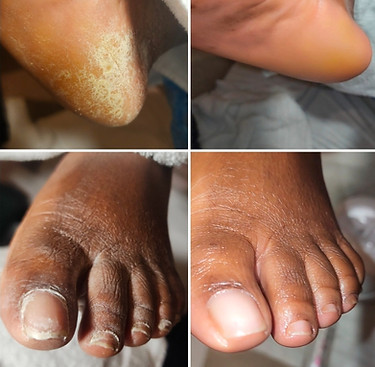 Heal by Sole Mobile Wellness Pedicures in Richmond, VA (6)