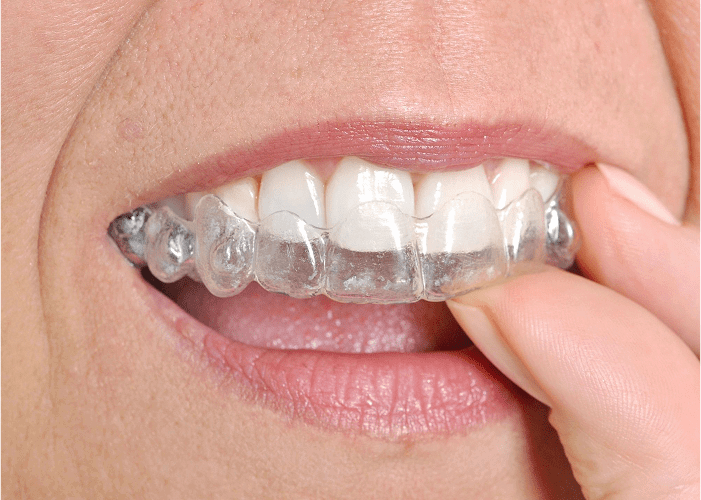 Bay City Dental in Bay City, TX (4)