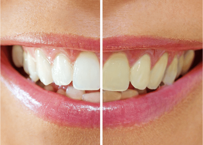 Bay City Dental in Bay City, TX (6)