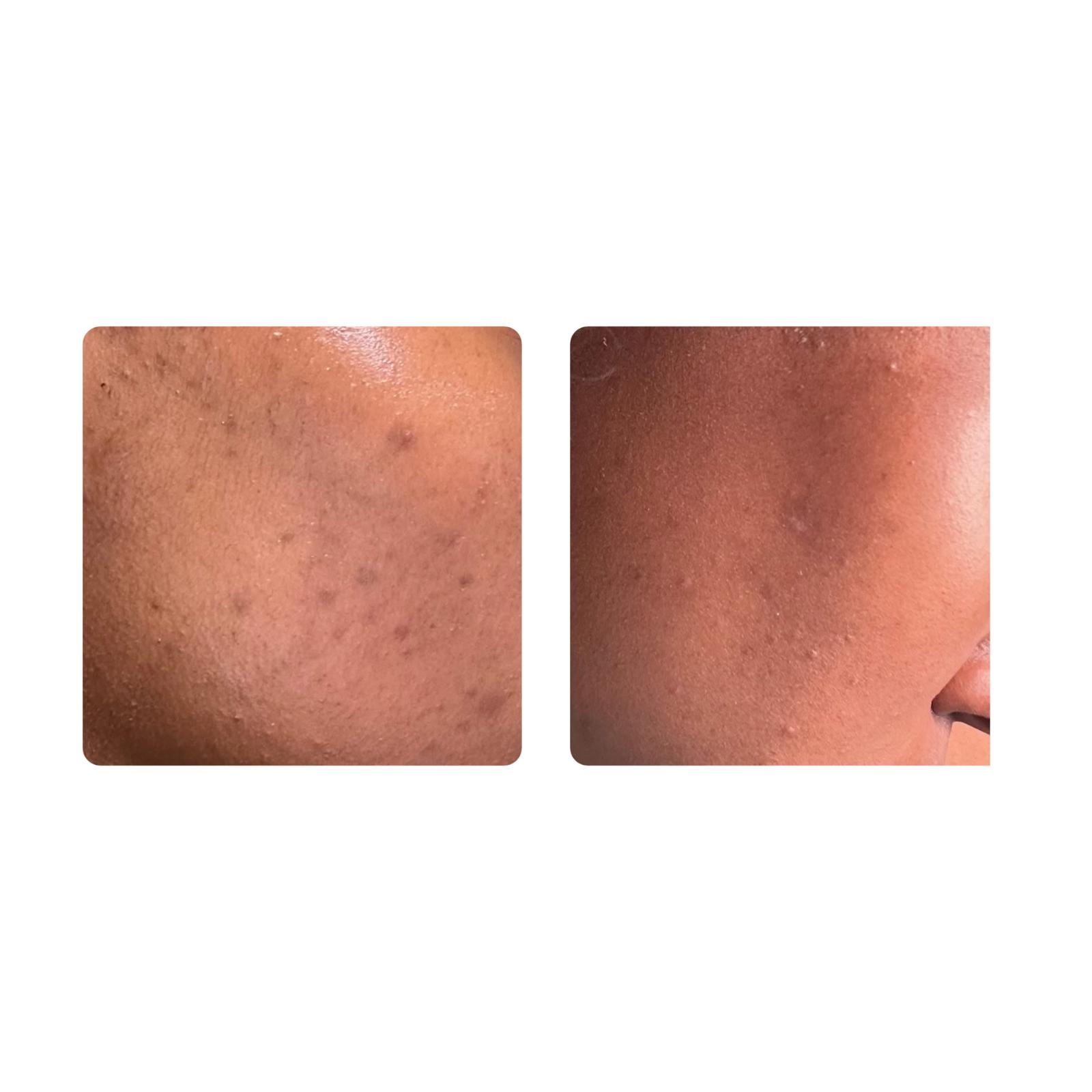 Skin By Naj in South Charleston, WV