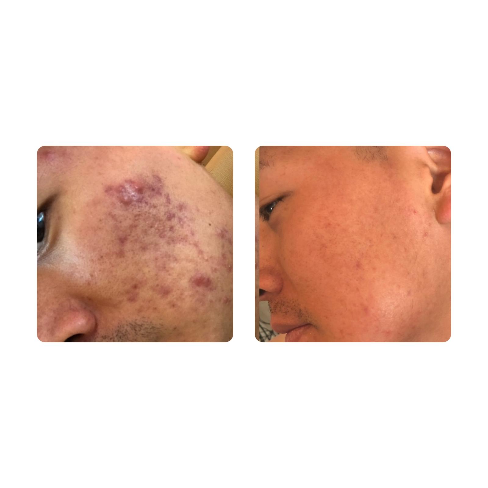 Skin By Naj in South Charleston, WV (4)