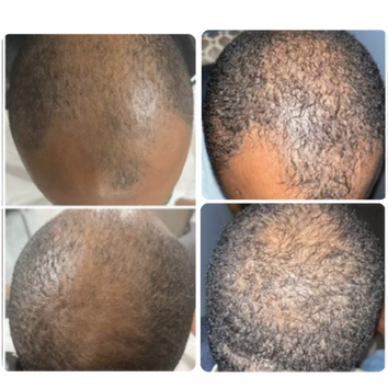 Gifted Creations Salon, Spa & Restoration Hairloss Clinic in Midway, GA (4)