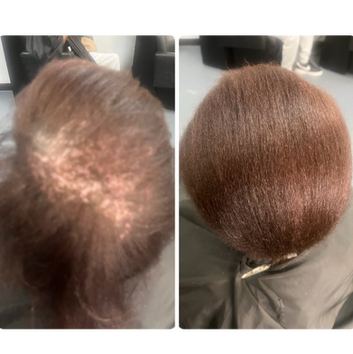 Gifted Creations Salon, Spa & Restoration Hairloss Clinic in Midway, GA (5)