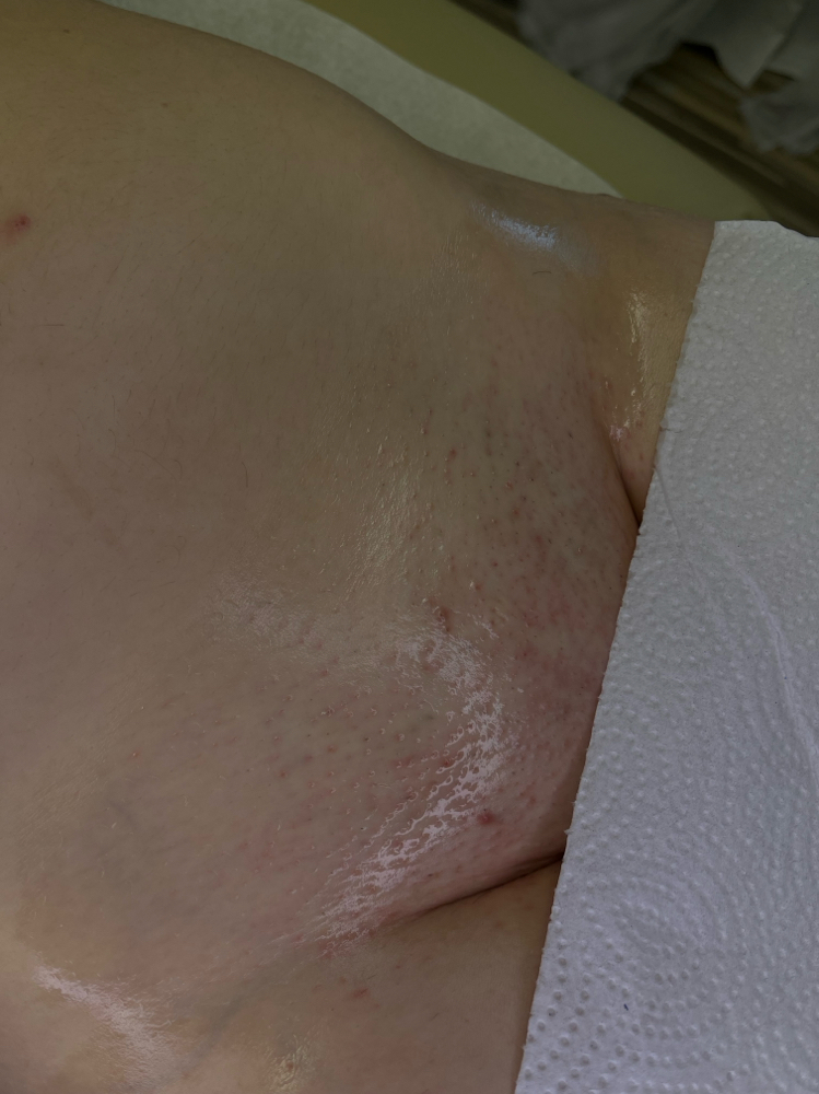 4 the Girls Esthetics in Woodmere, OH (3)