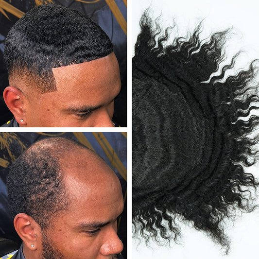 Hair Replacement Crown in Bronx, NY (5)