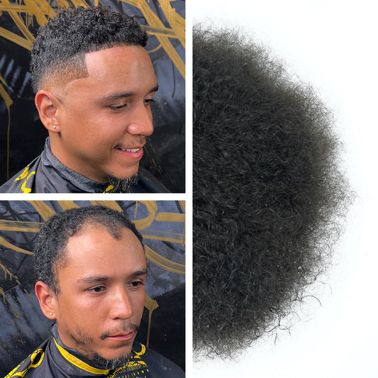 Hair Replacement Crown in Bronx, NY (6)