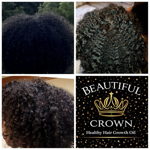 Beautiful Crown 🌿 🌻 in Avon, IN (3)
