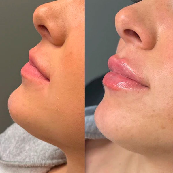 Class Skin Wellness Center & Spa Skin Body Care in Union City, NJ (5)