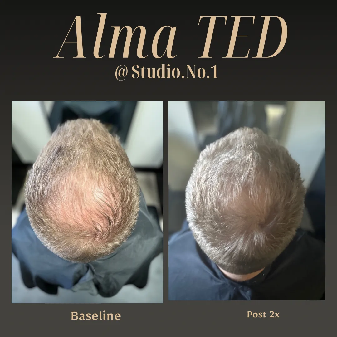 STUDIO.NO.1 Hair Replacement Salon in Palmdale, CA (5)