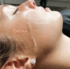 Skin Health LLC in Marysville, OH (3)