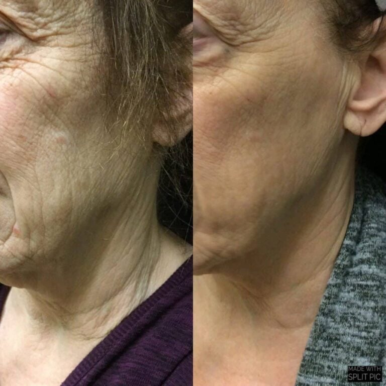 Beautibar aesthetics and wellness in Chillicothe, OH (3)