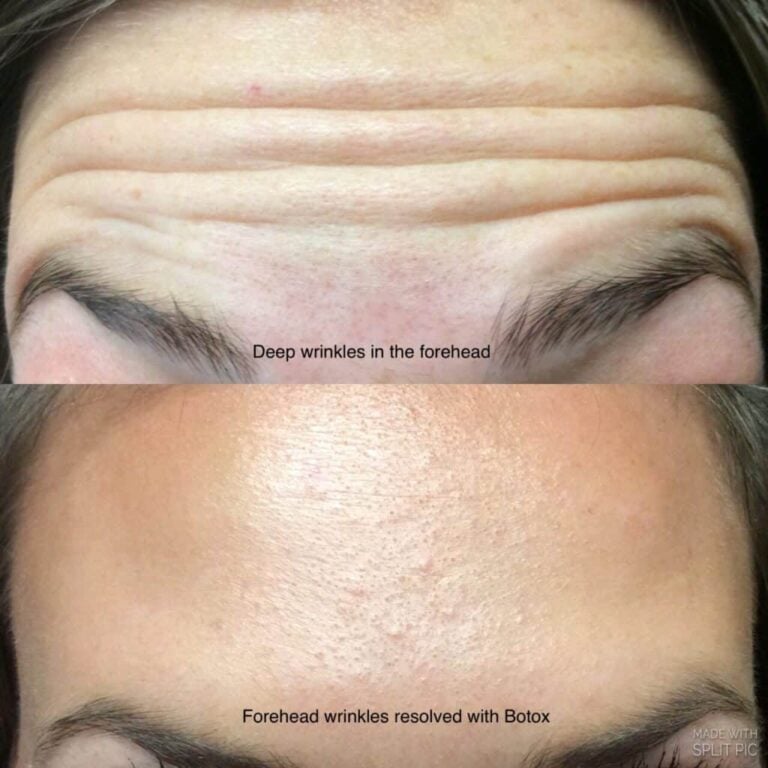 Beautibar aesthetics and wellness in Chillicothe, OH (4)