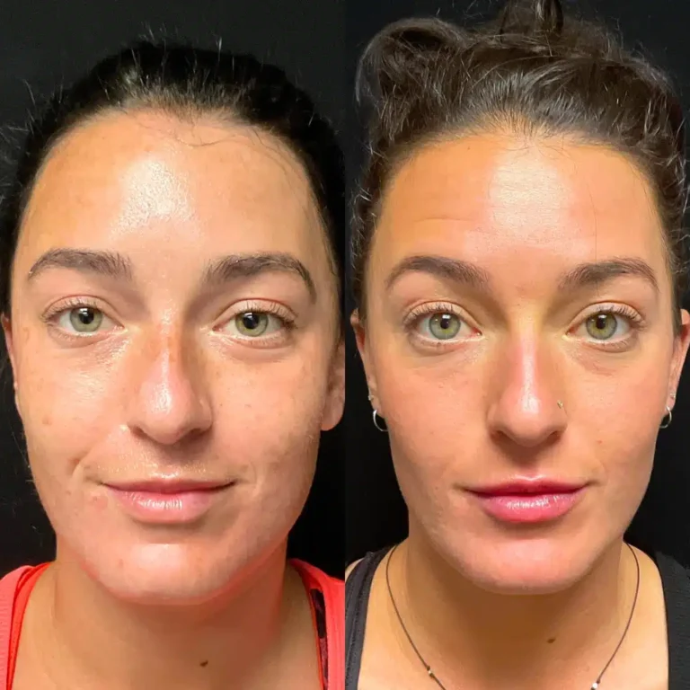 Beautibar aesthetics and wellness in Chillicothe, OH (6)